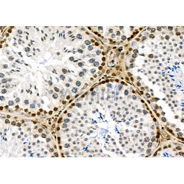 NKAP Antibody - DF9069 at 1/100 staining Mouse testis tissue by IHC-P.