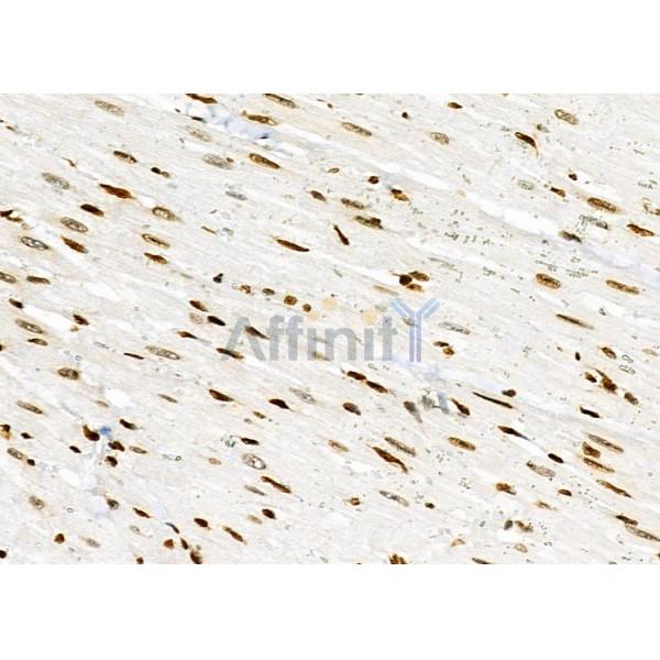 NKAP Antibody - DF9069 at 1/100 staining Rat heart tissue by IHC-P.