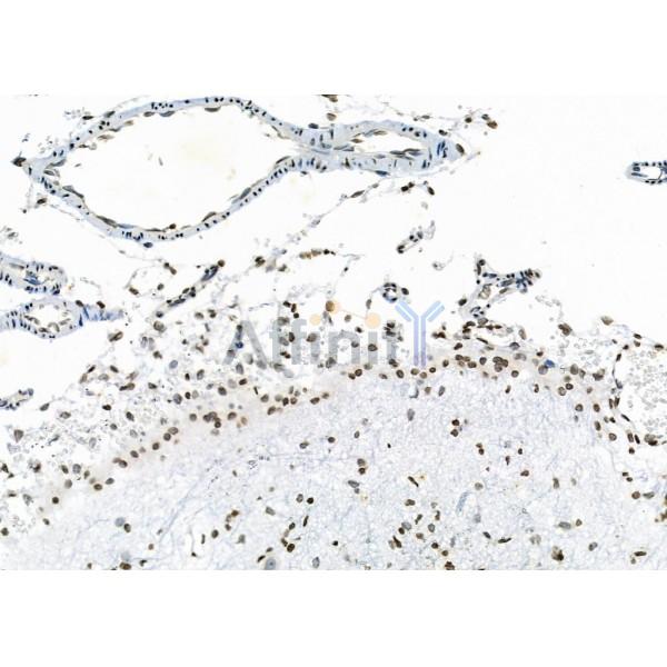 NKAP Antibody - DF9069 at 1/100 staining Rat brain tissue by IHC-P.