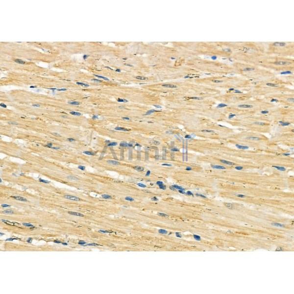 GOLT1B Antibody - DF9071 at 1/100 staining Rat heart tissue by IHC-P.