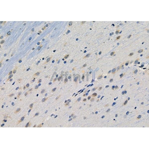 PER1 Antibody - DF9080 at 1/100 staining Rat brain tissue by IHC-P.