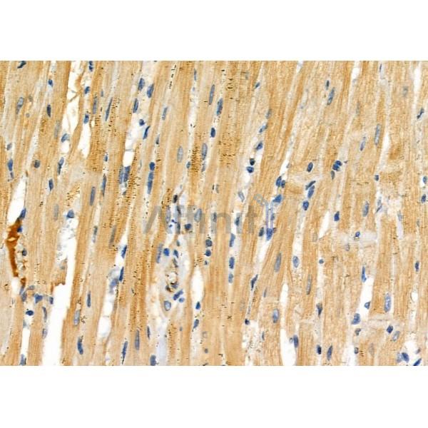 RPS26L1 Antibody - DF9121 at 1/100 staining Rat heart tissue by IHC-P.