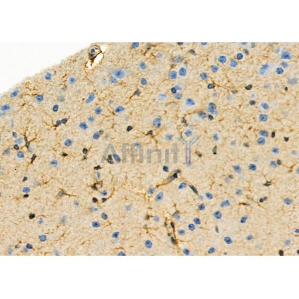 AOAH Antibody - DF9158 at 1/100 staining Mouse brain tissue by IHC-P.