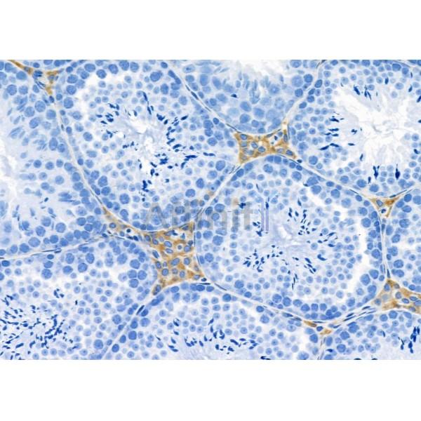 AOAH Antibody - DF9158 at 1/100 staining Mouse testis tissue by IHC-P.