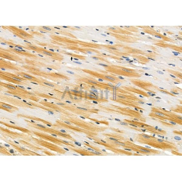 AOAH Antibody - DF9158 at 1/100 staining Rat heart tissue by IHC-P.
