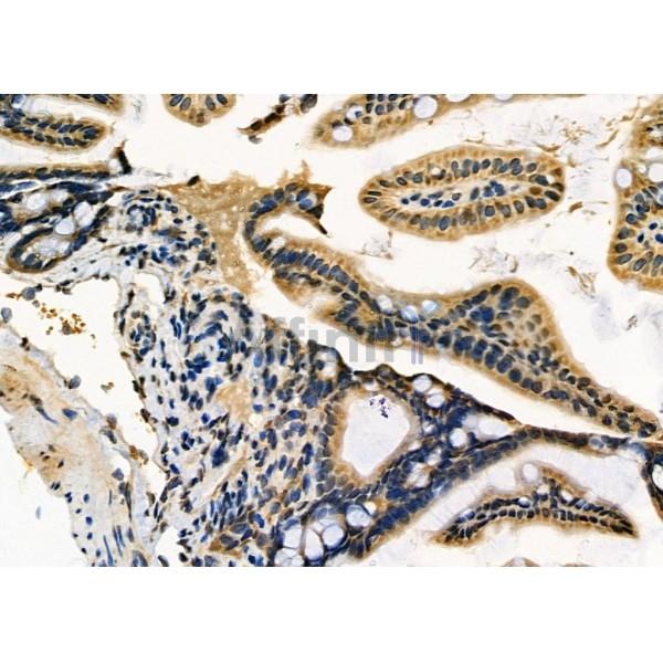 ADAMTS20 Antibody - DF9176 at 1/100 staining Mouse colorectal tissue by IHC-P.