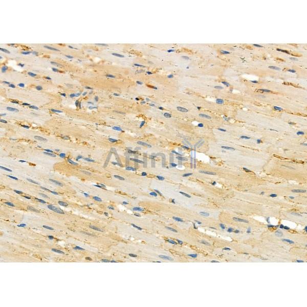SERPINA2 Antibody - DF9193 at 1/100 staining Rat heart tissue by IHC-P.
