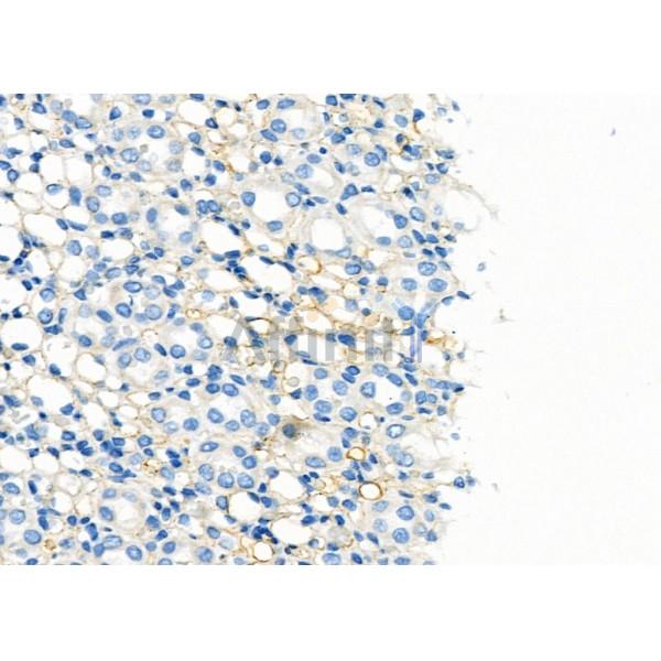 AQP6 Antibody - DF9223 at 1/100 staining Rat kidney tissue by IHC-P.