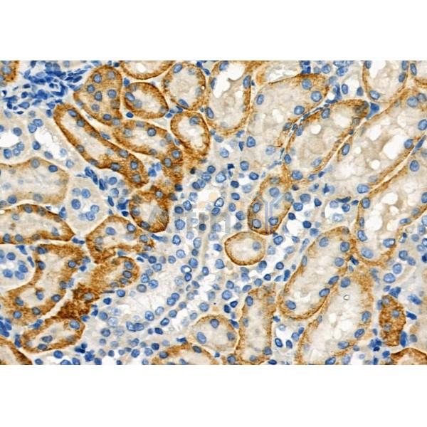 SLC7A10 Antibody - DF9230 at 1/100 staining Rat kidney tissue by IHC-P.