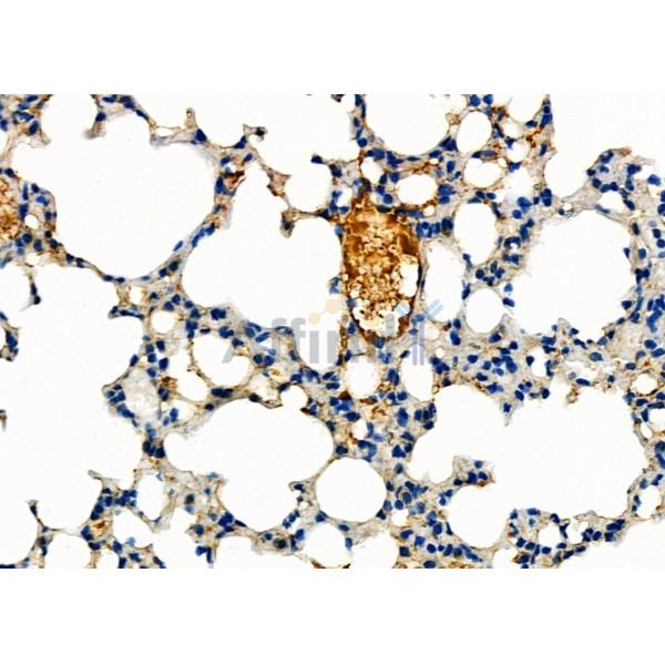 ABCA3 Antibody - DF9245 at 1/100 staining Mouse lung tissue by IHC-P.