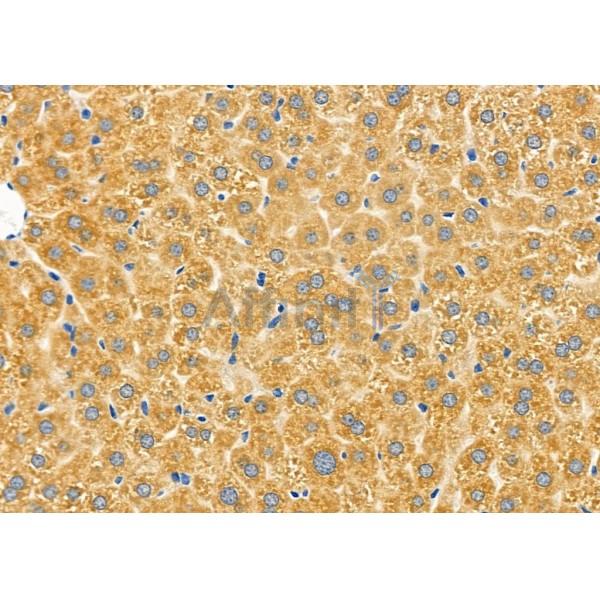 CHST14 Antibody - DF9331 at 1/100 staining Mouse liver tissue by IHC-P.
