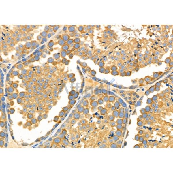 CHST14 Antibody - DF9331 at 1/100 staining Mouse testis tissue by IHC-P.