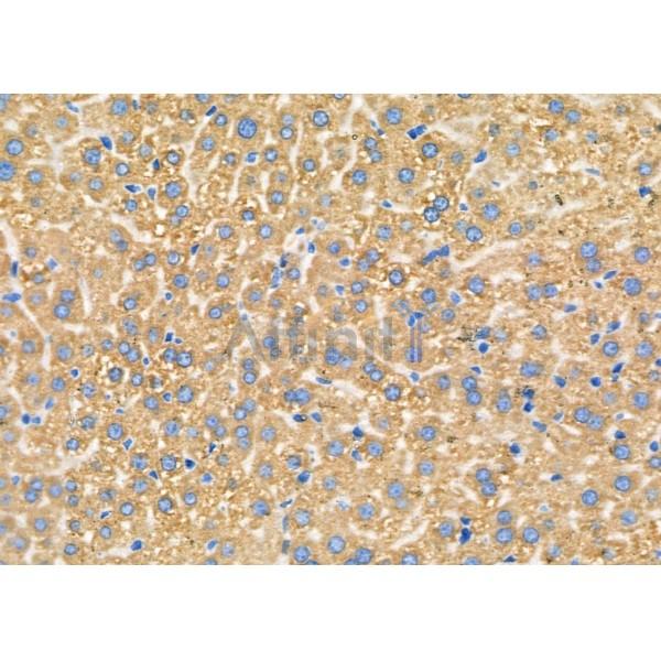 CEP110 Antibody - DF9360 at 1/100 staining Mouse liver tissue by IHC-P.