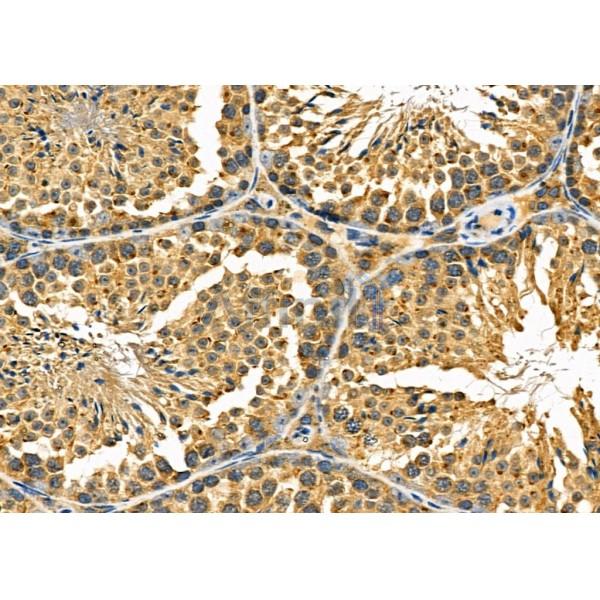CEP110 Antibody - DF9360 at 1/100 staining Mouse testis tissue by IHC-P.
