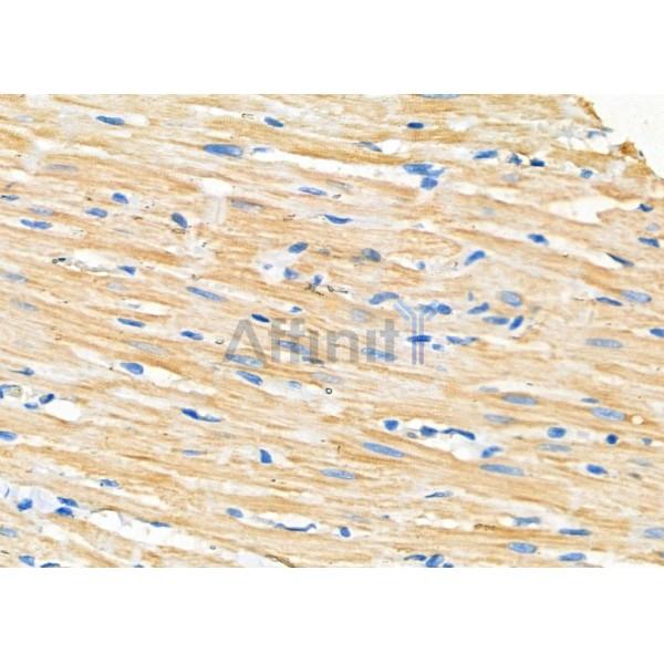 CEP110 Antibody - DF9360 at 1/100 staining Rat heart tissue by IHC-P.