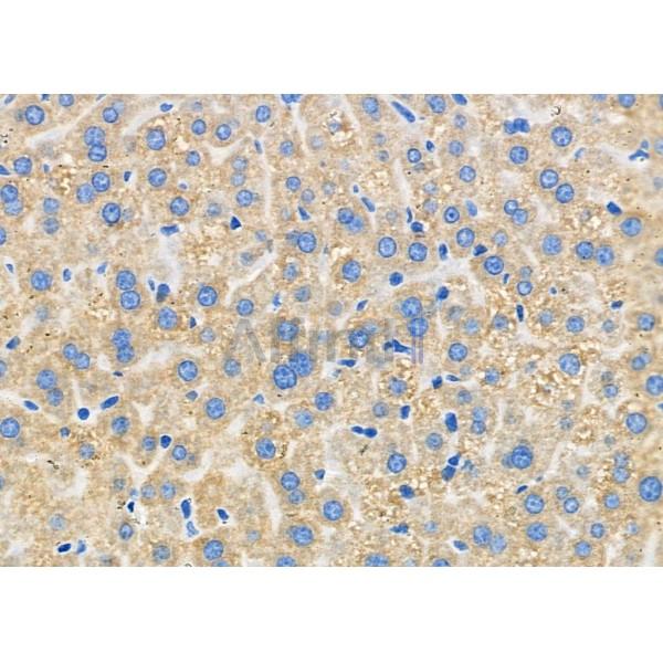CKLF8 Antibody - DF9389 at 1/100 staining Mouse liver tissue by IHC-P.
