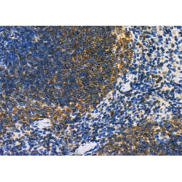 DYNLRB1 Antibody - DF9471 at 1/100 staining Mouse spleen tissue by IHC-P.