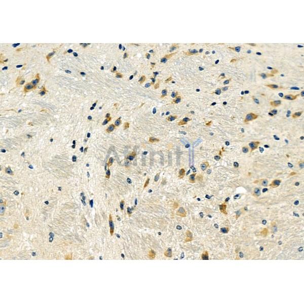 DYNLRB1 Antibody - DF9471 at 1/100 staining Mouse brain tissue by IHC-P.