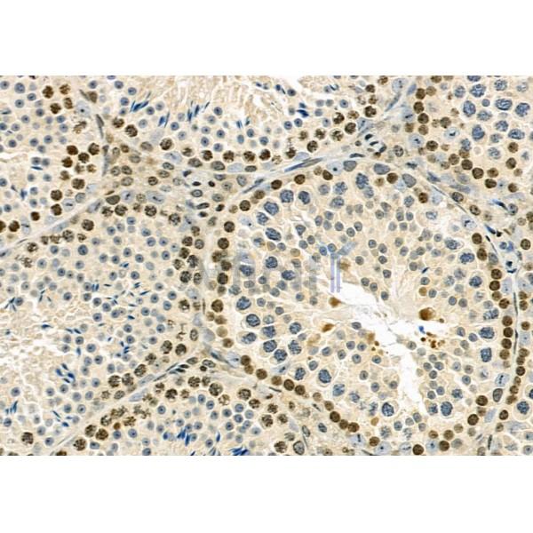RNF41 Antibody - DF9486 at 1/100 staining Mouse testis tissue by IHC-P.