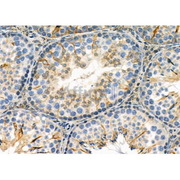 RNF167 Antibody - DF9489 at 1/100 staining Mouse testis tissue by IHC-P.