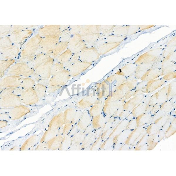 ZNRF1 Antibody - DF9492 at 1/100 staining Rat skin tissue by IHC-P.