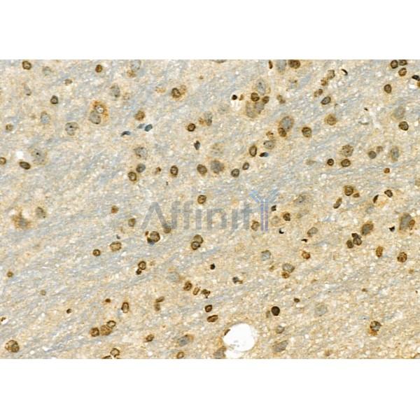 GPATCH8 Antibody - DF9522 at 1/100 staining Rat brain tissue by IHC-P.