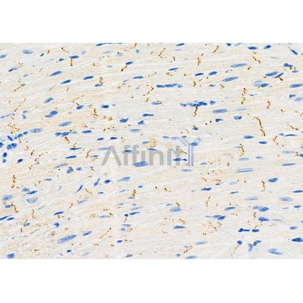 SAR1A Antibody - DF9554 at 1/100 staining Mouse heart tissue by IHC-P.