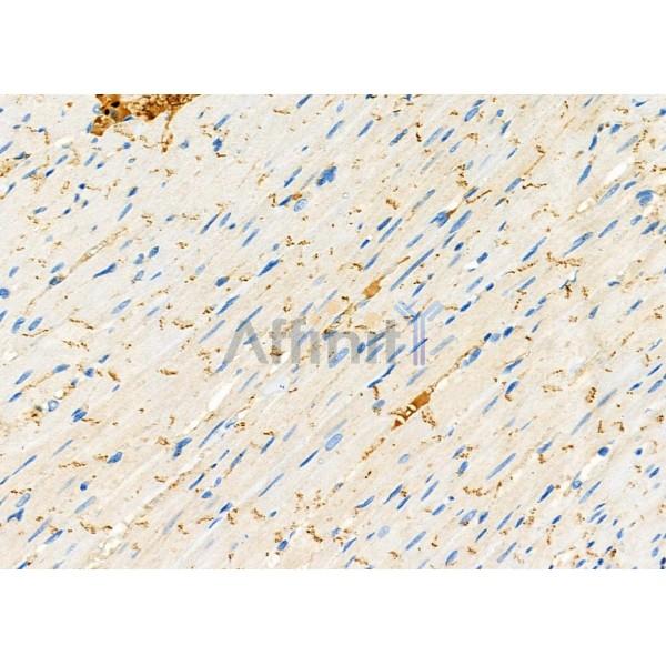 SAR1A Antibody - DF9554 at 1/100 staining Rat heart tissue by IHC-P.