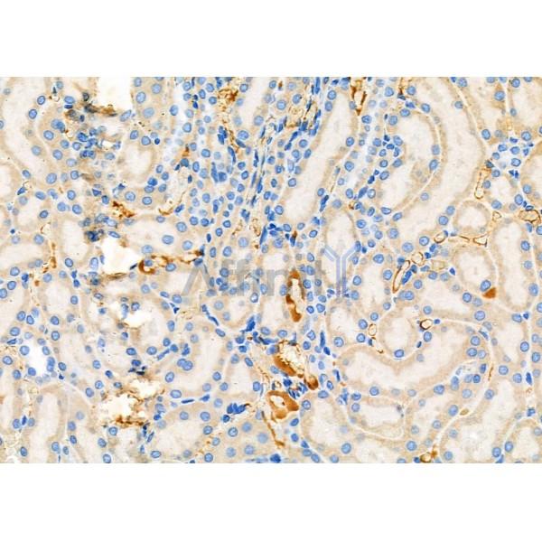 SAR1A Antibody - DF9554 at 1/100 staining Rat kidney tissue by IHC-P.