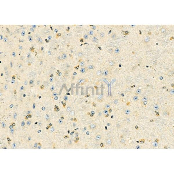 HOXB3 Antibody - DF9577 at 1/100 staining Mouse brain tissue by IHC-P.