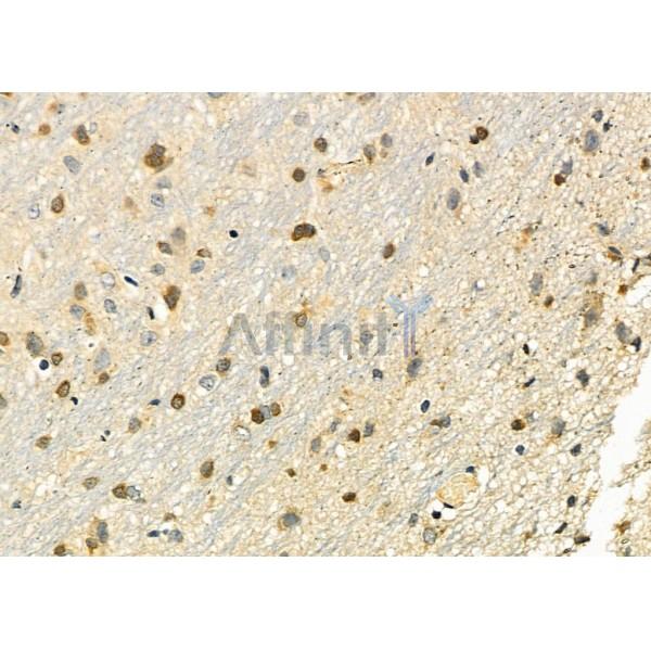 HOXB3 Antibody - DF9577 at 1/100 staining Rat brain tissue by IHC-P.
