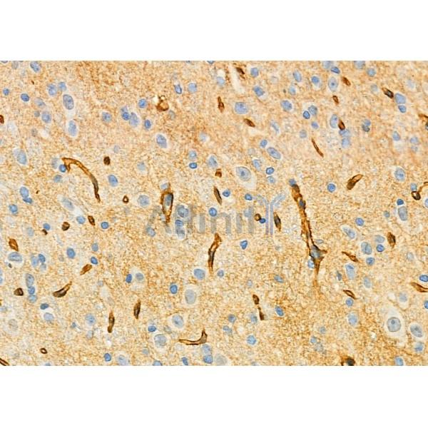 USP54 Antibody - DF9595 at 1/100 staining Rat brain tissue by IHC-P.