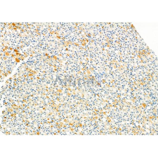 LRP1B Antibody - DF9609 at 1/100 staining Rat kidney tissue by IHC-P.