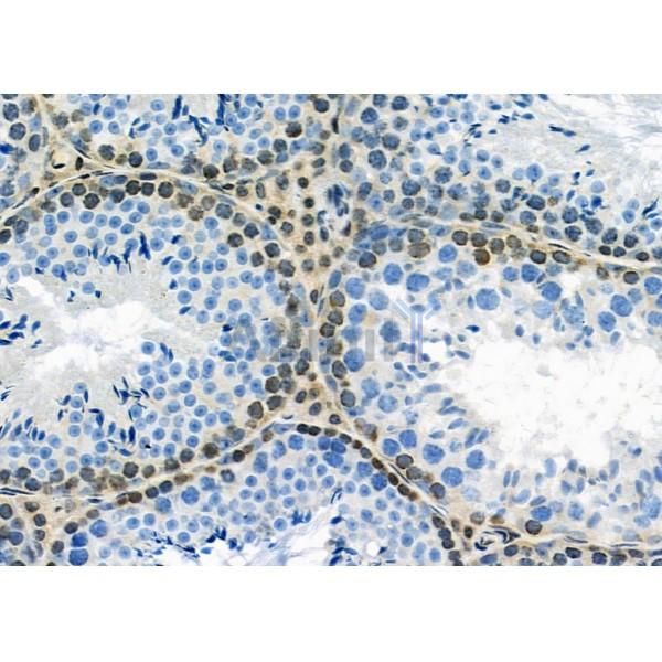 MED29 Antibody - DF9616 at 1/100 staining Mouse testis tissue by IHC-P.