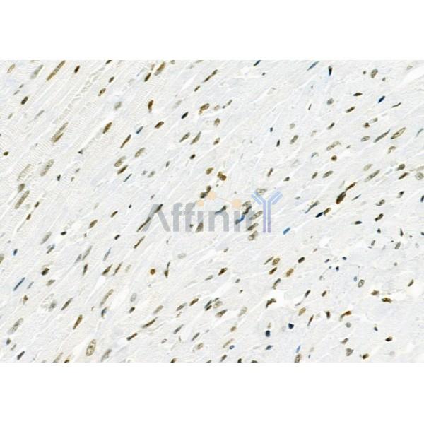 MED29 Antibody - DF9616 at 1/100 staining Rat heart tissue by IHC-P.
