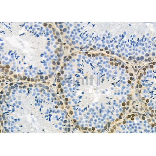 MED29 Antibody - DF9616 at 1/100 staining Rat brain tissue by IHC-P.