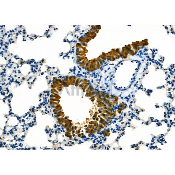 MED31 Antibody - DF9618 at 1/100 staining Mouse lung tissue by IHC-P.