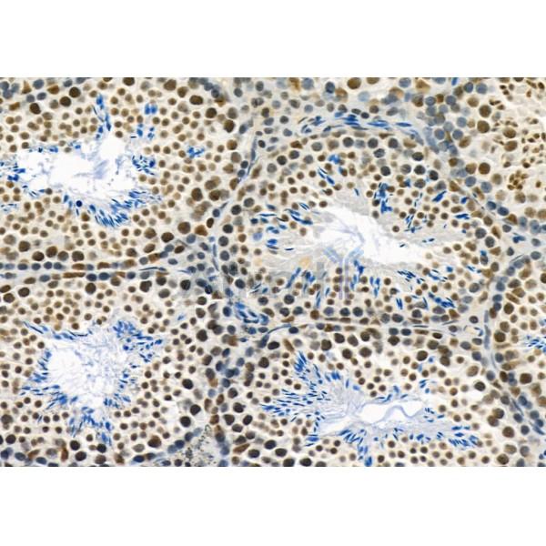 MED31 Antibody - DF9618 at 1/100 staining Mouse testis tissue by IHC-P.