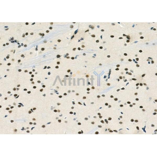 MED31 Antibody - DF9618 at 1/100 staining Rat brain tissue by IHC-P.
