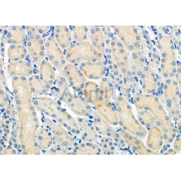 MOT6 Antibody - DF9634 at 1/100 staining Rat kidney tissue by IHC-P.