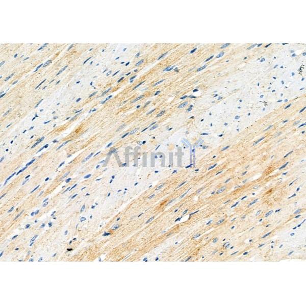 MEGF6 Antibody - DF9644 at 1/100 staining Rat heart tissue by IHC-P.