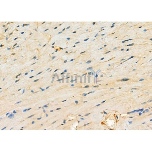 MYO5C Antibody - DF9653 at 1/100 staining Mouse heart tissue by IHC-P.