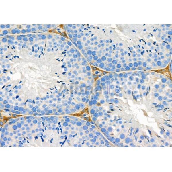 MYO5C Antibody - DF9653 at 1/100 staining Mouse testis tissue by IHC-P.