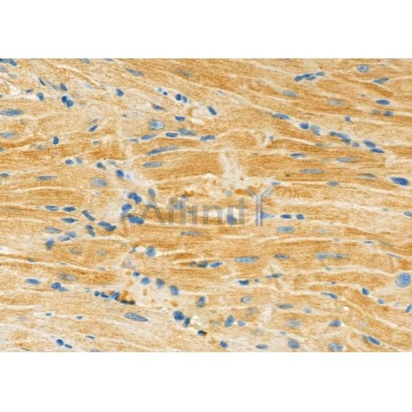 MYO6 Antibody - DF9654 at 1/100 staining Mouse heart tissue by IHC-P.