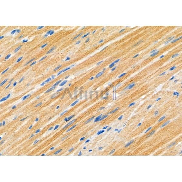 MYO6 Antibody - DF9654 at 1/100 staining Rat heart tissue by IHC-P.