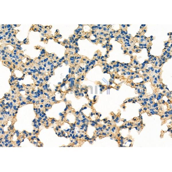 MYO16 Antibody - DF9656 at 1/100 staining Mouse lung tissue by IHC-P.