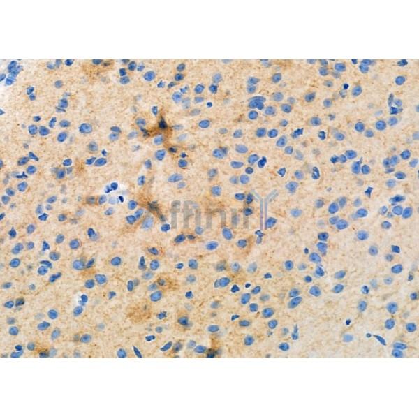 NCALD Antibody - DF9687 at 1/100 staining Mouse brain tissue by IHC-P.