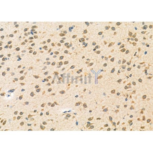 NEUROD4 Antibody - DF9689 at 1/100 staining Mouse brain tissue by IHC-P.