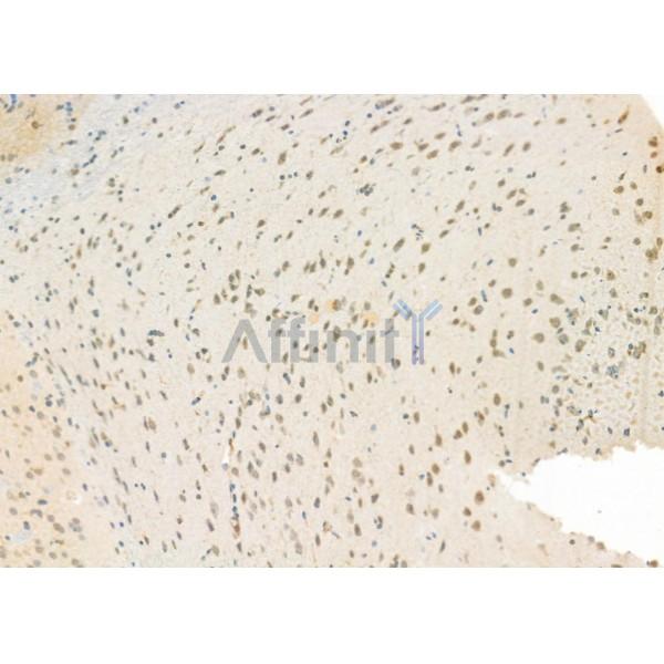 NEUROD4 Antibody - DF9689 at 1/100 staining Rat brain tissue by IHC-P.
