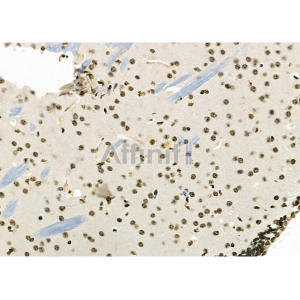 NOL7 Antibody - DF9720 at 1/100 staining Mouse brain tissue by IHC-P.